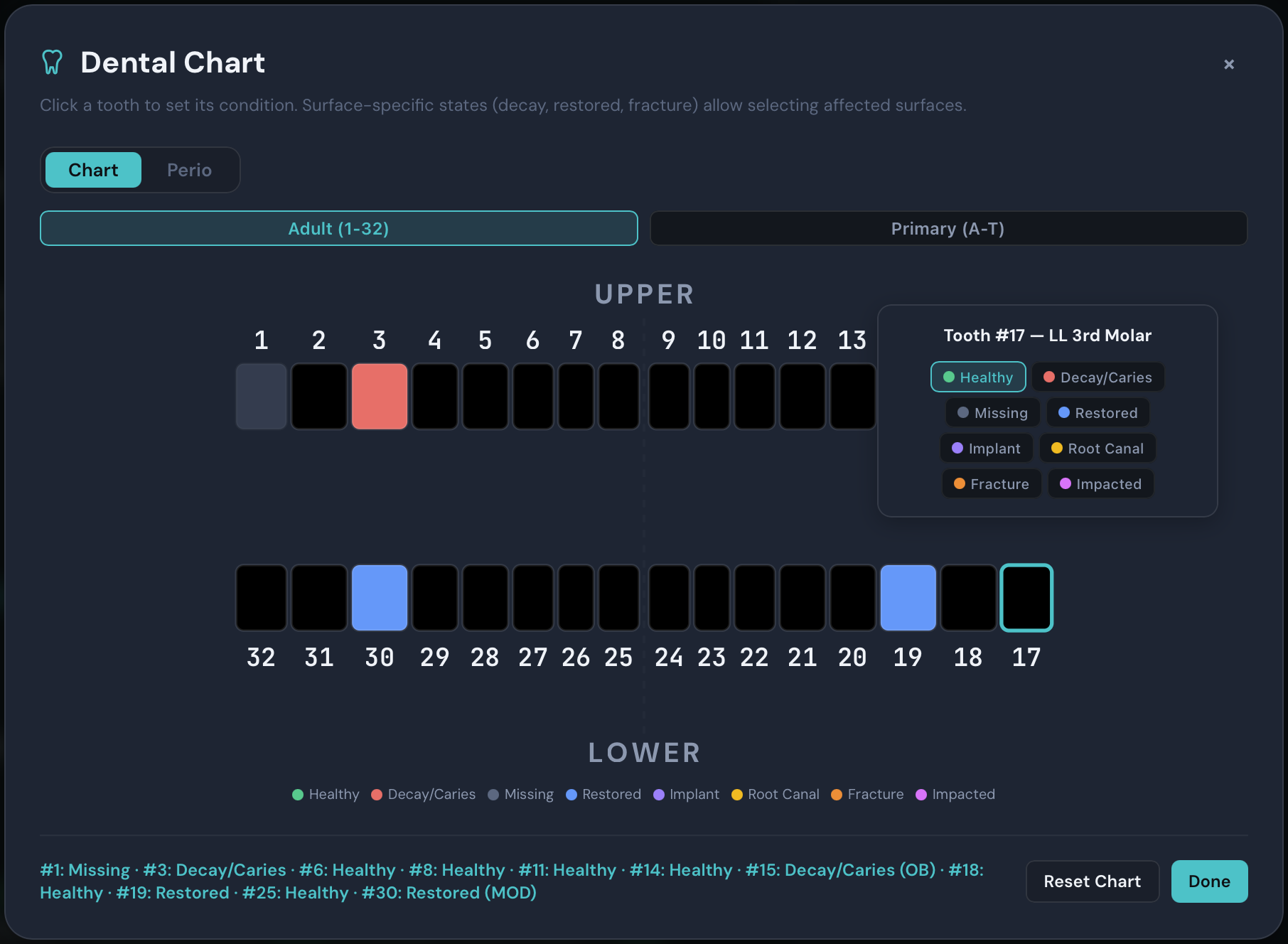 Interactive dental chart showing 32-tooth adult chart with color-coded conditions, perio tab, and upper/lower arch view
